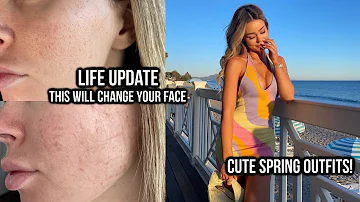 Life update! I got a face procedure! New makeup products/routine! Spring White Fox clothing haul!