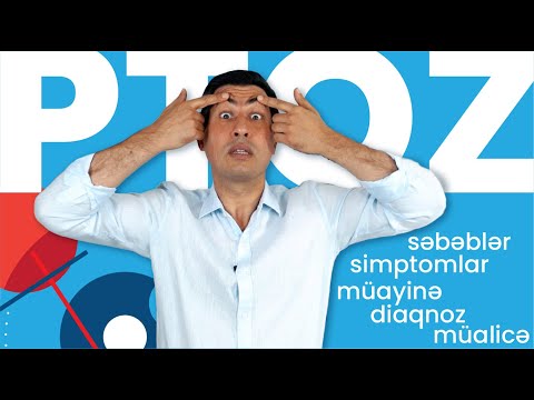 Video: Münxhauzen sindromu - simptomlar və müalicə