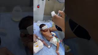 Feeding By Ng To Cute Baby