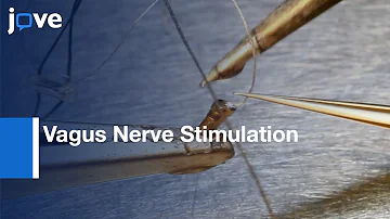 Vagus Nerve Stimulation: Induce Plasticity-Pathways Relevant: Extinction Learning l Protocol Preview