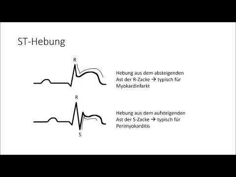 EKG verstehen; die Grundlagen (EKG Crashkurs Teil 1)