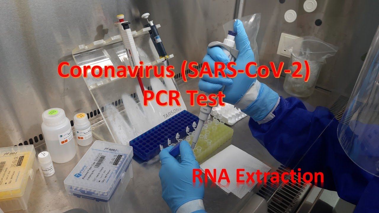Coronavirus RNA Extraction /pooling of samples for testing SARS-COV-2