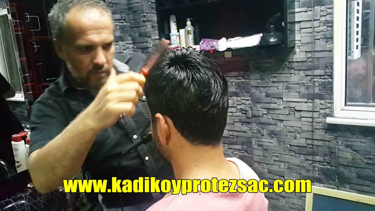 Kadikoy Protez Sac Protez Sac Istanbul Protez Sac Erkeklere Protez Sac Youtube