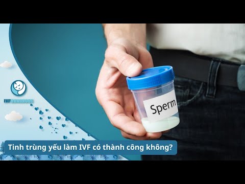 Tinh Trùng Yếu Có Thụ Tinh Nhân Tạo Được Không - Tinh Trùng Yếu Có Làm Thụ Tinh Ống Nhiệm IVF Được Không ?