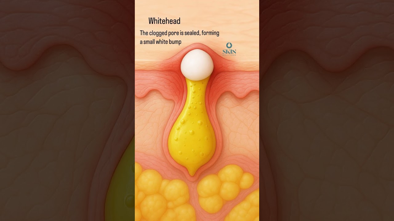 Fine Lines Around the Eyes? Seriskin Can Help | Click Link in Comments