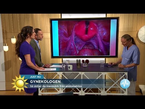 Hur behandlar man sjukdomen endometrios? - Nyhetsmorgon (TV4)