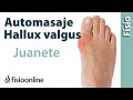 Automasaje para el hallux valgus o "juanete"