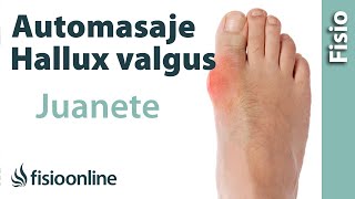 Automasaje para el hallux valgus o 'juanete'