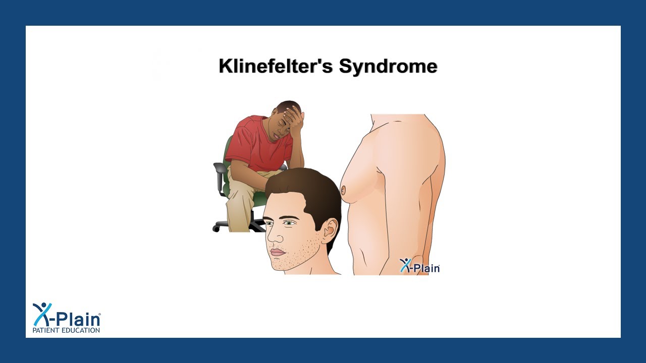 Klinefelters Syndrome Youtube