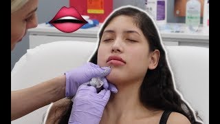 GETTING MY LIPS DONE AT LASER AWAY VLOG Experience LIVE FOOTAGE