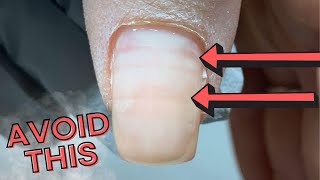 Over Filed Nails - How to Avoid Rings of Fire