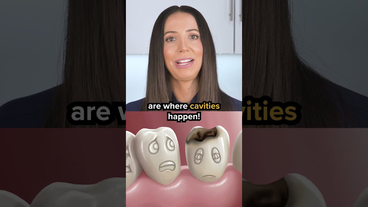Non Fluoride Toothpaste Nano Hydroxyapatite Explained Shorts