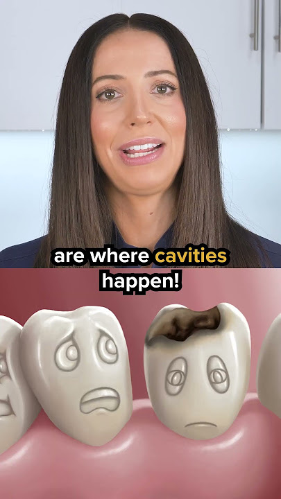 non-fluoride toothpaste (nano-hydroxyapatite toothpaste) explained #shorts