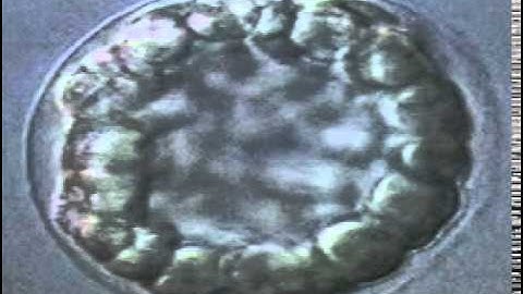 Sea Urchin Early Cleavage