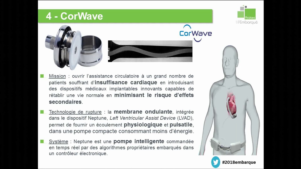 Corwave CorWave, une pompe cardiaque inspirée par la nature - YouTube