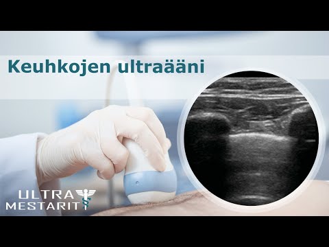 Video: Pitäisikö Ultraäänianturin Korvata Stetoskooppi? SICS-I-alitutkimus, Jossa Verrattiin Keuhkojen Ultraääntä Ja Keuhkojen Auskultaatiota Kriittisesti Sairailla