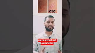 Eczema(दाद) के लक्षण और उपाय।#eczema #allergy #skincare #steroid#skin#youtubeshorts #dharmahealthhub