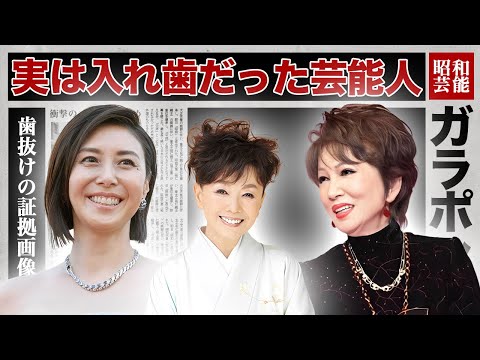 実は入れ歯だった女性芸能人・有名人１８選【※歯美人】