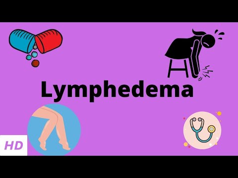 Lymphedema, Causes, Signs and Symptoms, Diagnosis and Treatment.