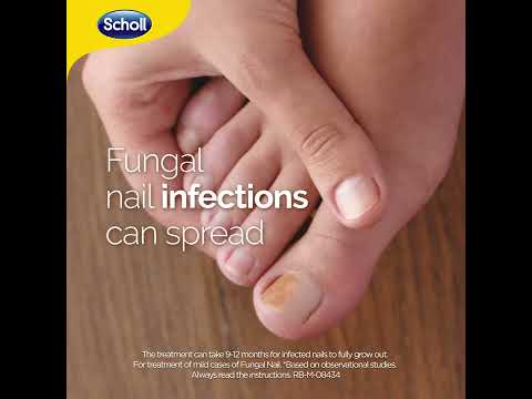 Buy Dr. Scholl's Fungal Nail Revitalizer at Well.ca | Free Shipping $49+ in  Canada