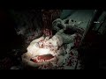 Perfect 1 bullet 4 kills | Resident Evil Requiem