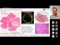 Cox t 2022 tumour microenvironment
