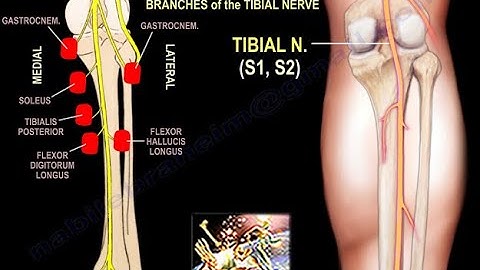 Sciatic Nerve Course, Branches to Lower Leg & Foot- Everything You Need To Know - Dr. Nabil Ebraheim