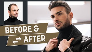 Spontaneous transformation with a hairsystem: Does he like his new hairstyle?