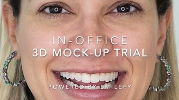 3D Dental Mock-up Workflow - SmileFy (3D Design to Smile Trial)