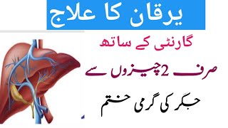 Yarkan ka ilaj in urdu | Liver Swelling Treatment In Urdu | Fatty Liver | Liver Problem Treatment