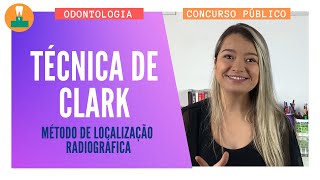 Técnica de Clark - Método de Localização Radiográfica [Concurso Público]