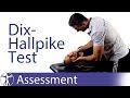 Dix Hallpike Test | Posterior BPPV