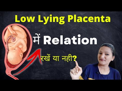 Low lying Placenta mai Relation banana chahiye ya nahi? Pregnancy mai Low lying Placenta ||