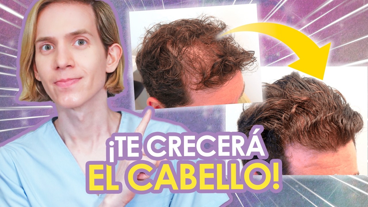 5 COSAS que TE HARÁN CRECER EL PELO desde CASA