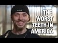 Mountain Dew Mouth and the Worst Teeth in America