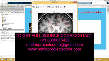 Matlab code for Weighted Level Set Evolution Based on Local Edge Features for Medical Image