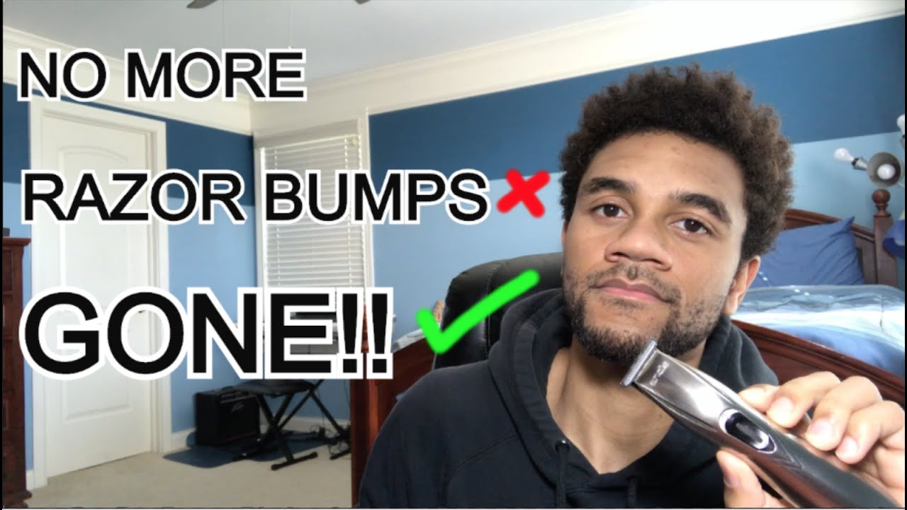 How To PREVENT RAZOR BUMPS - Get Rid of Razor Bumps & Ingrown Hairs - YouTube