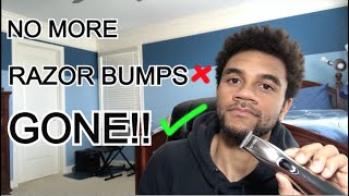 How To PREVENT RAZOR BUMPS  Get Rid of Razor Bumps & Ingrown Hairs