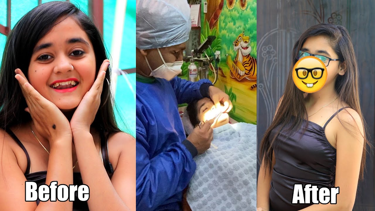 OMG!!!How do i Look Now!🤓 Ye kya ho Gaya Mere Sath Lag Gai mere Teeths Me Clips And Braces