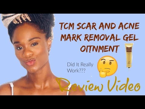 TCM Scar and Acne Mark Removal Gel Ointment/ Did it really work?? Review Video