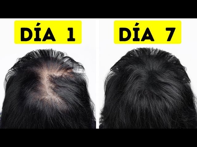 Fui de cabello delgado a grueso en solo una semana -