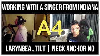 Singing Tips : Working on Laryngeal Tilt with Neck Anchoring