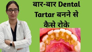 Dental calculus// Dental tartar// tartar control//बार-बार tartar बनने से कैसे रोके// teeth whitening