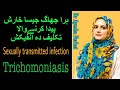 Trichomoniasis Trichomonas Vaginalis ہرے رنگ کا جھاگ جیساڈسچارج 