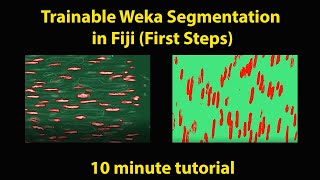 Trainable Weka Segmentation (Fiji Tutorial)