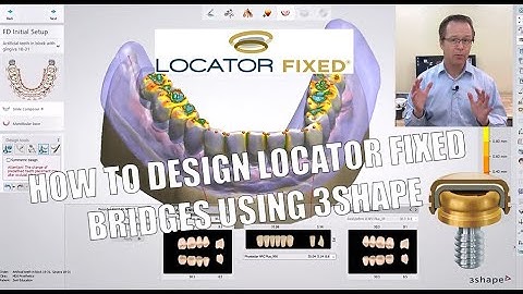 How to Design LOCATOR FIXED Prosthetics / Bridges Using 3Shape Dental System - Fundamentals & More