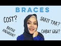 Apa yang kita patut tahu sebelum pakai braces