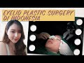 Eyelid plastic surgery in indonesia  the clinic beautylosophy