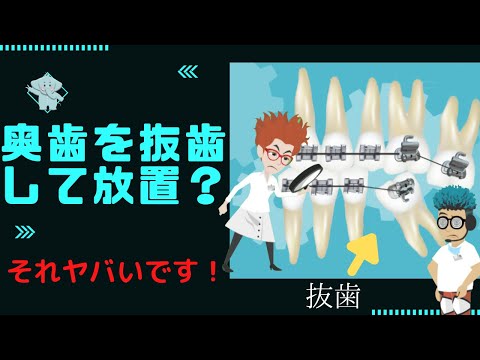 上顎・下顎の奥歯6番・7番を抜歯後、そのまま放置するとどうなる？