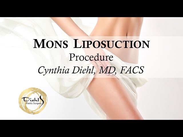 Mons Liposuction, Vaginal Rejuvenation